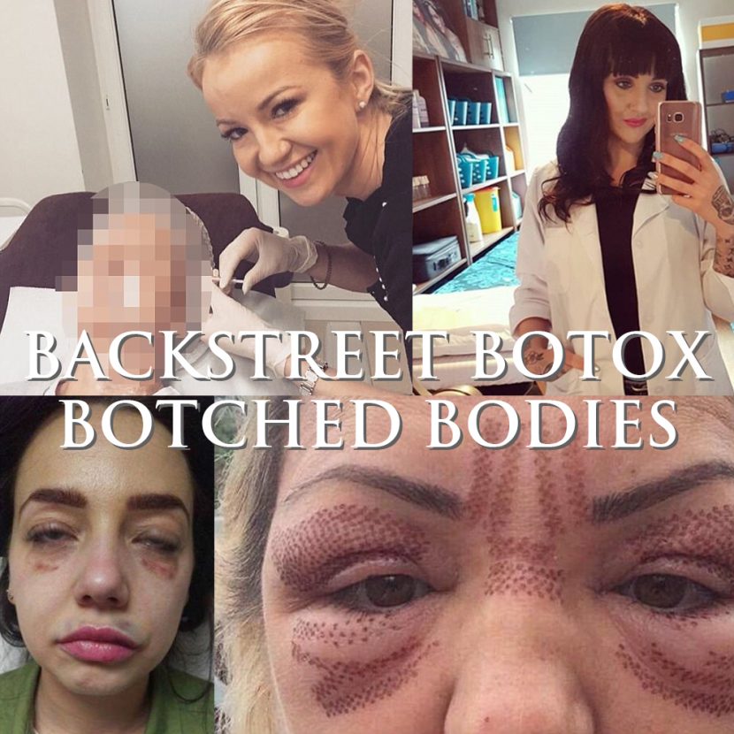 Medispa S10 Sheffield Social Media Post Template Backstreet Botox 007