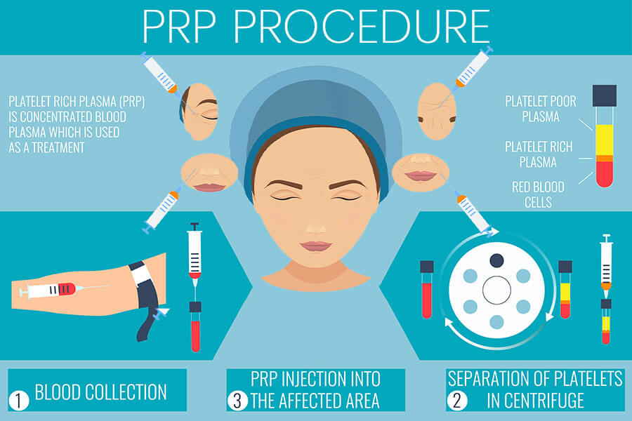Medispa-S10-Sheffield-PRP-Stem-Cell-Therapy-Treatment