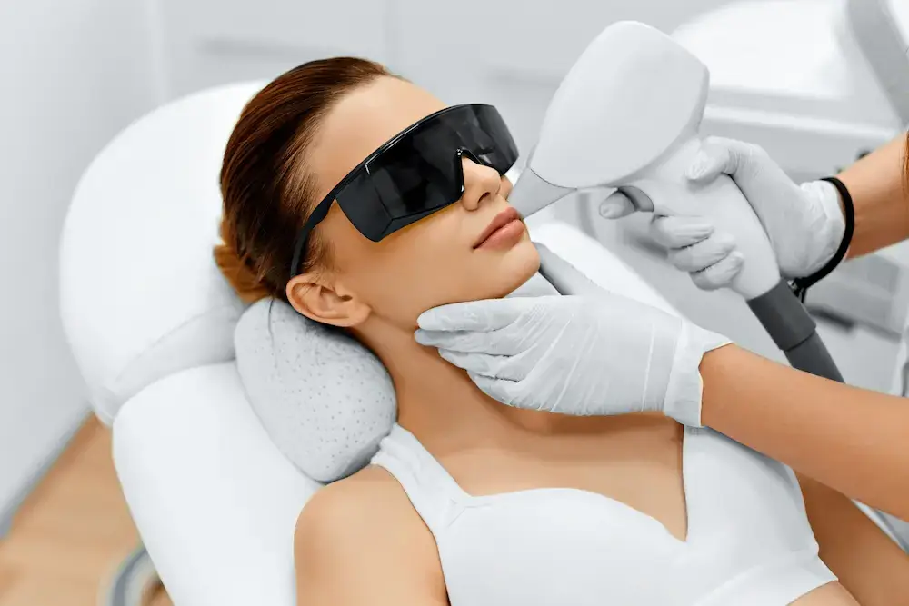 image of a woman receiving upper lip laser hair removal treatment in sheffield.